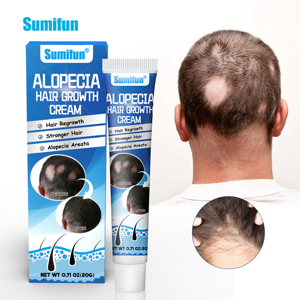 Alopecia Hair Growth Cream,Hair Regrowth Cream For Thicker Hair Sophora Alopecia Areata Cream Healthcare Supply Hair Care
